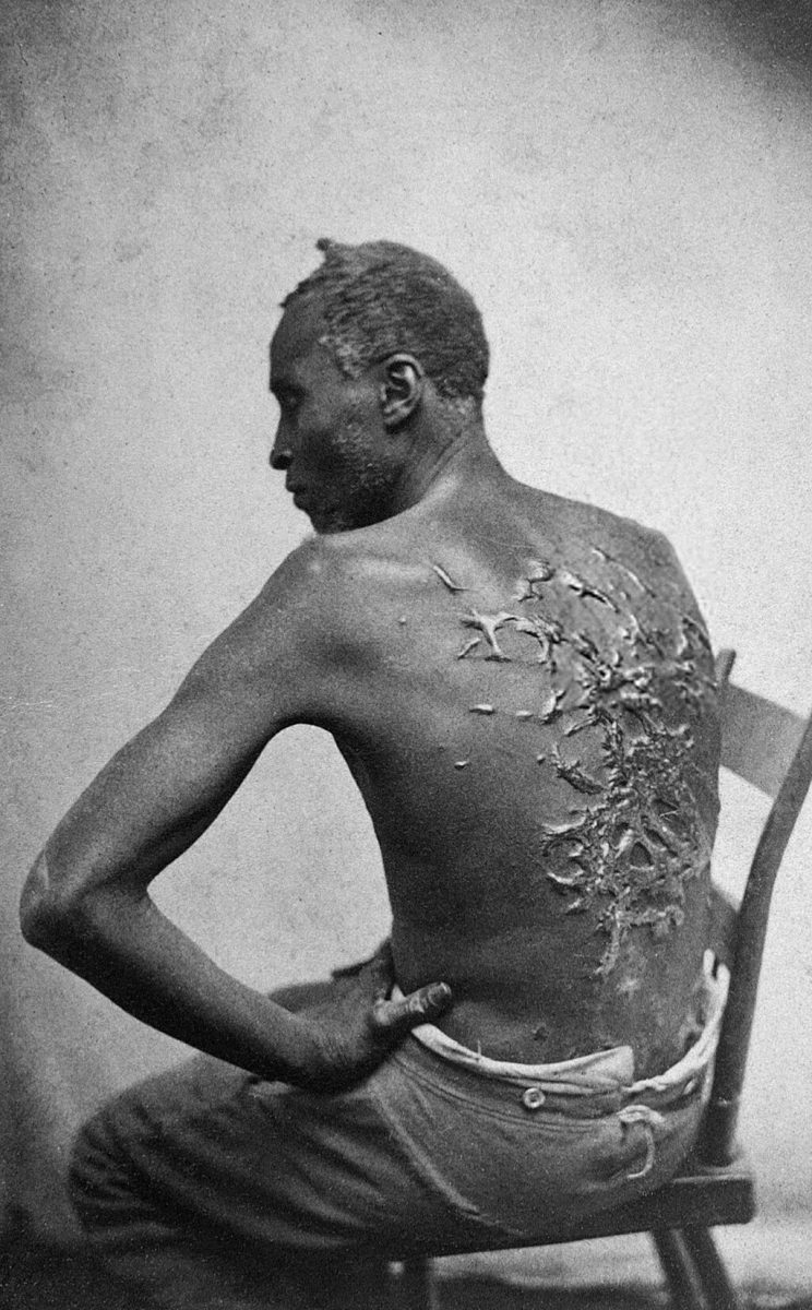The Scourged Back